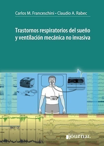 Trastornos Respiratorios Del Sueño Y Ventilación Mecánica N