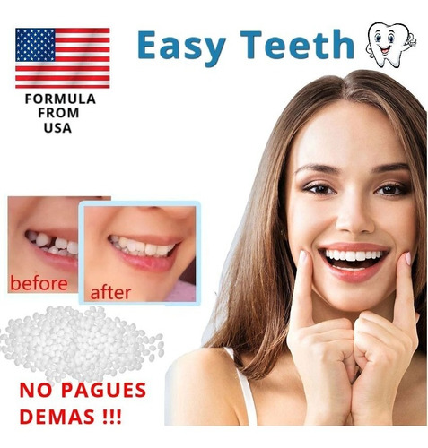 Imagen 1 de 6 de Kit Diente Provisorio Para Reemplazar Un Diente Easy Teeth