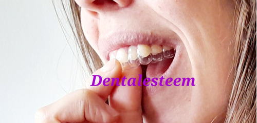 Placas De Contencion Post Ortodoncia