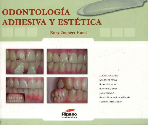 Libro Odontología Adhesiva Y Estética De Rony Joubert Hued