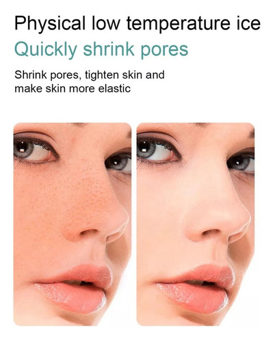 Rolo Facial De Gelo Para Rosto E Olhos, Rolo Facial