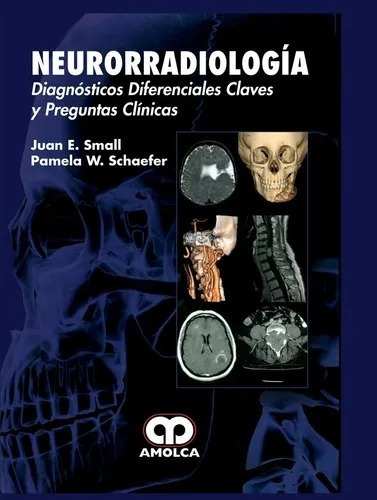 Neurorradiologia Diagnósticos Diferenciales