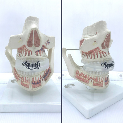 Protetor Bucal Profissional Com Estojo Arcada Superior Spank Cor Transparente Sabor Sem Sabor