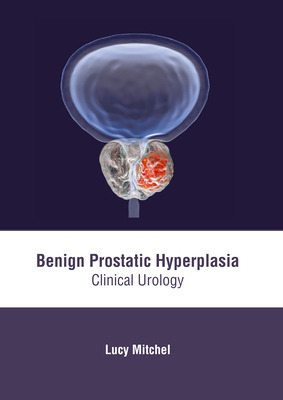Libro Benign Prostatic Hyperplasia: Clinical Urology - Mi...