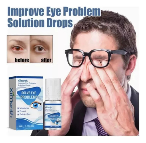 Gotas Para La Salud Ocular, Gotas Relajantes Para Ojos Secos