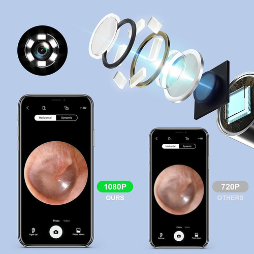 Wi-fi Visual Earpick - Kit De Herramientas De Eliminación De