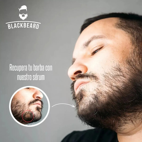 Minoxidil 10% Roll On Blackbeard Con Cafeína 10 Piezas