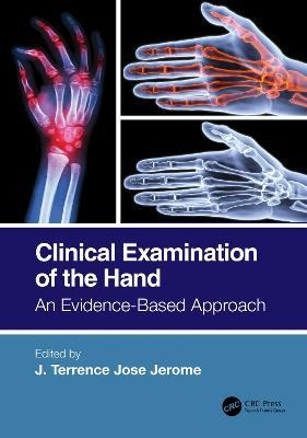 Libro Clinical Examination Of The Hand : An Evidence-base...