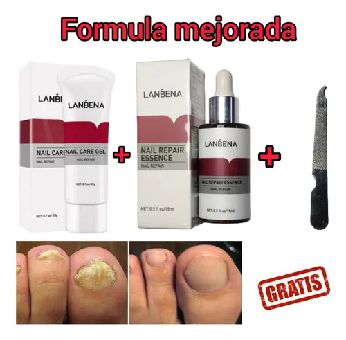 comprar Pack Formula Mejorada Elimina Los Hongos De Las Uñas