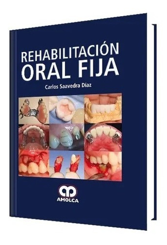 Rehabilitación Oral Fija.