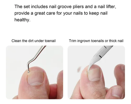 Kit De Herramientas Para Uñas Encarnadas, Cortaúñas, Alicate