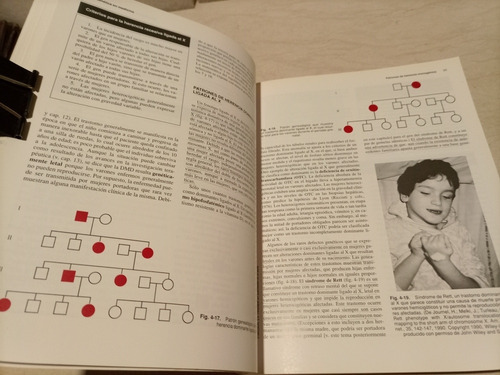 Libro. Genética En Medicina. Masson (Usado)