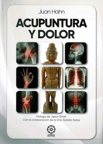 Acupuntura Y Dolor