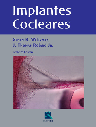 Implantes Cocleares, de Waltzman, Susan B.. Editora Thieme Revinter Publicações Ltda, capa dura em português, 2015