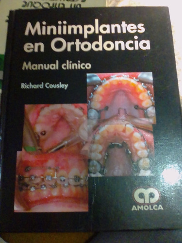 Mini Implantes En Ortodoncia Manual Clínico Amolca Cousley