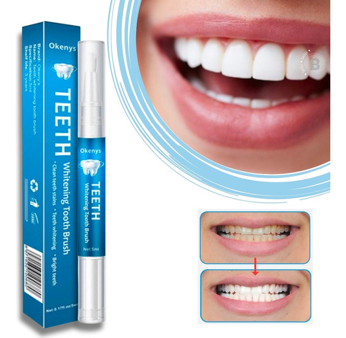 Kit 3 Canetas Clarear Branqueador Dentes - Sorriso Bbb!!