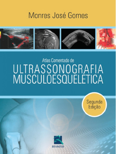 Atlas Comentado De Ultrassonografia Musculoesqueletica