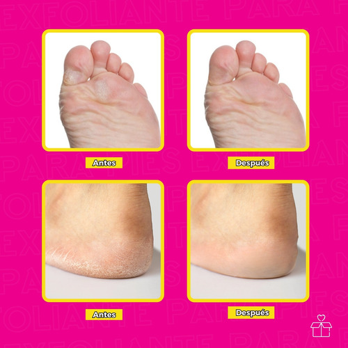 Gel Exfoliante Para Pies Bioaqua Masaje Suavizante