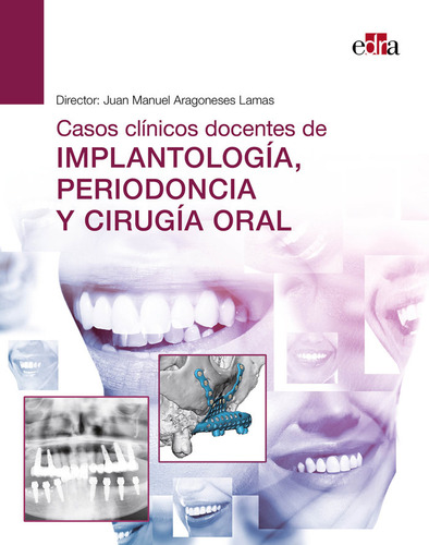Libro Casos Clinicos Docentes De Implantologia Periodonci...