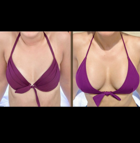 Aumento Crecimiento De Senos Chichis Bubis Tetas Pecho Busto