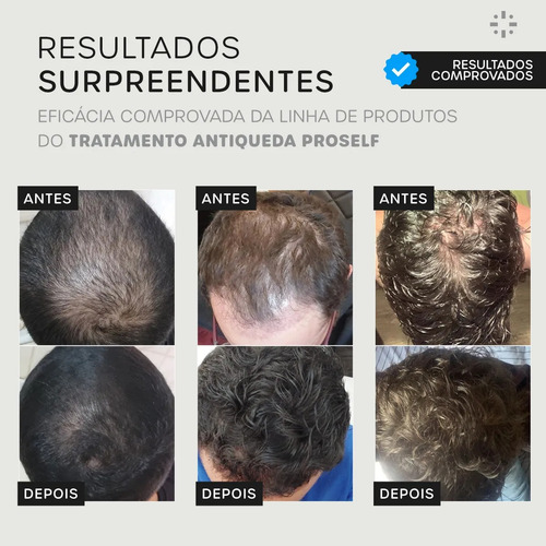 Tônico Capilar Natural Proself Vegano Crescimento E Volume