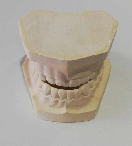 Modelo Dental De Yeso Odontología
