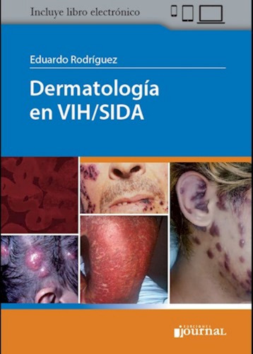 Dermatología En Vih/sida. Incluye E-book. Rodriguez