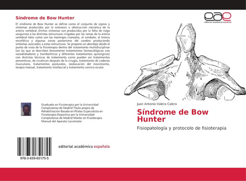 Libro: Síndrome Bow Hunter: Fisiopatología Y Protocolo