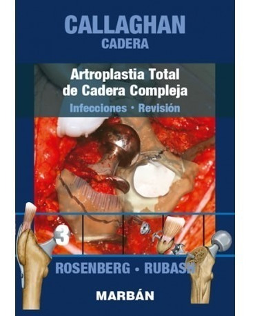 Callaghan Cadera Tomo 3 Artroplastia Total Cadera Compleja