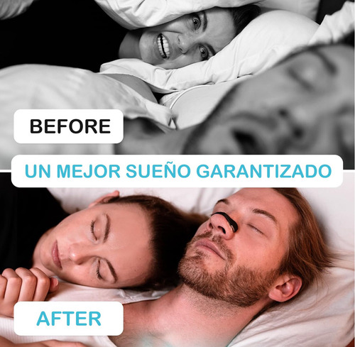 Tiras Nasales Antirronquidos Dilatadores Nasales Magnéticos Diseño Innovador Para Mejorar La Respiración OXYGLOW Pack 30
