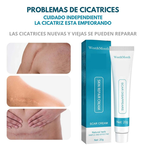 Crema Despigmentante De Manchas Para Cicatrices Paño Acne