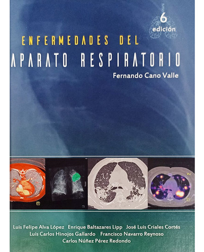 Enfermedades Del Aparato Respiratorio / 6 Ed.