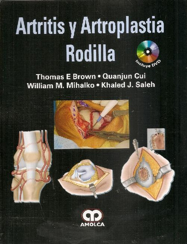 Libro Artritis Y Artroplastia Rodilla De Thomas E Brown Quan