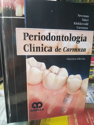 Periodontologia Clínica De Carranza 11 Edición 
