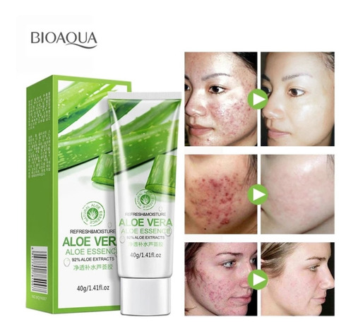 Gel Aloe Vera Bioaqua Anti Acne,manchas,aclara Puntos Negros