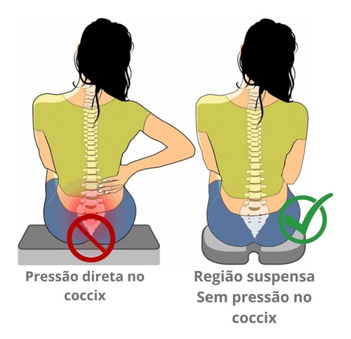 Assento Almofada Coccix Escara Hemorroida Abertura Traseira
