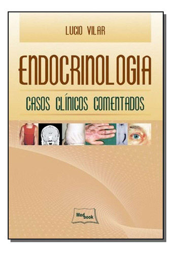 Libro Endocrinologia Casos Clinicos Comentados De Vilar Med