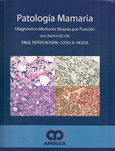 Libro Patología Mamaria De Paul Peter Rosen Seyd A Hoda