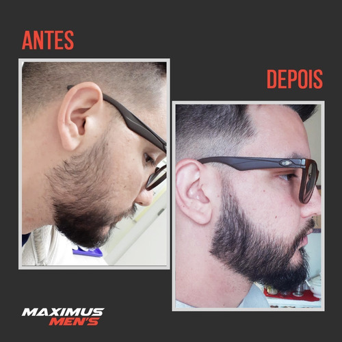 Imagem 5 de 10 de Maximus Beard Para Crescimento De Barba - Tratamento 30 Dias