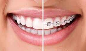 Imagen 1 de 1 de Dentista, 096014768, Odontólogo. Prótesis, Brackets