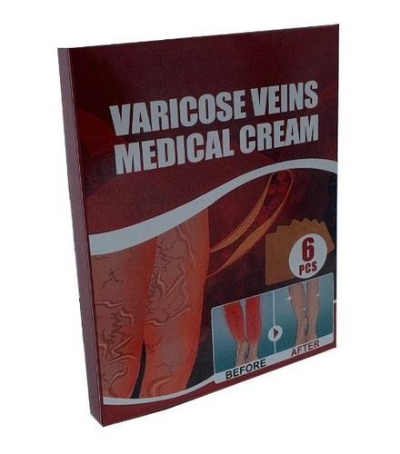 6 Parches Para Aliviar El Dolor De Las Varicosas Varices