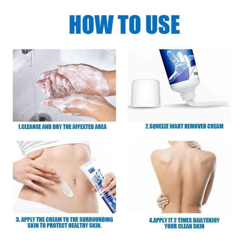 2* Pomada Cremosa Anti-verrugas, Creme Anti-sardas, Removedo