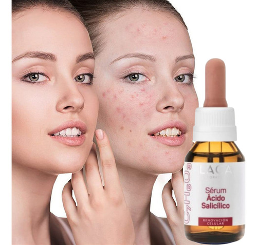 Serum Ácido Salicílico 2% Piel Grasa Reduce Poros Laca Grasa Noche