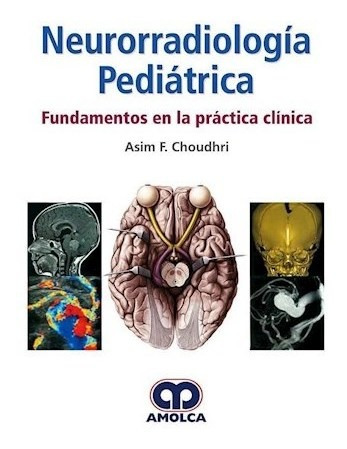 Neurorradiología Pediátrica Fundamentos En La Práctica Clín