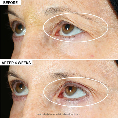 Strivectin Tighten & Lift Peptight - Suero Para Ojos De 360