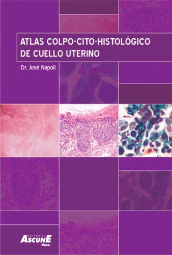 Atlas Colpo-cito-histológico De Cuello Uterino