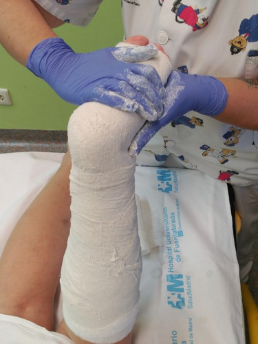 Venda De Yeso 7.5cmx 3m Yesoterapia Lesiones Moldes - 1 Unid