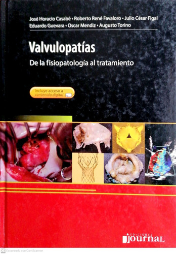 Valvulopatias De La Fisiopatologia Al Tratamiento