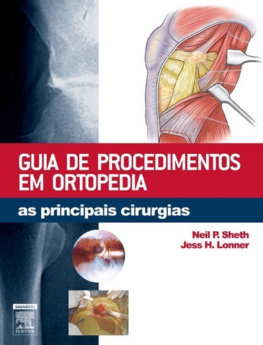 Livro - Guia De Procedimentos Em Ortopedia As Principais Cirurgias - Sheth, De Sheth, Neil P. - Lonner, Jess H.. Editora Elsevier Em Português