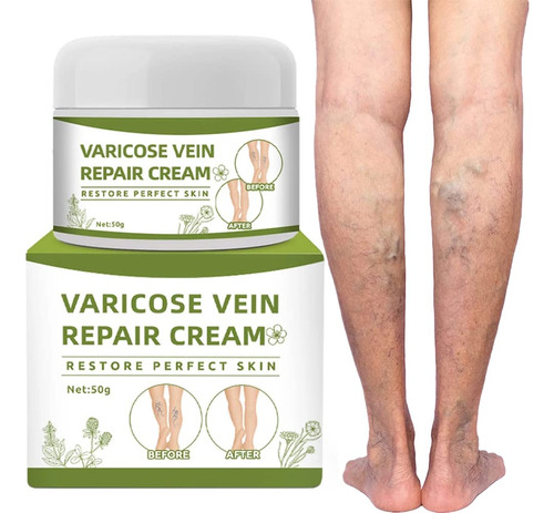 Klsychry Crema De Venas Varicosas, Crema Reparadora De Vena.